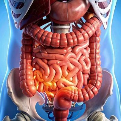 Sinal discreto no intestino pode evoluir para câncer com o tempo
