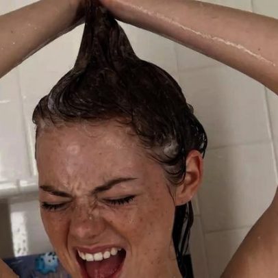 Banho perfeito para pele dura menos de 10 minutos, diz dermatologista