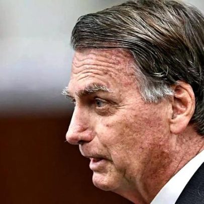 Bolsonaro é internado para cirurgia no ombro; entenda o quadro