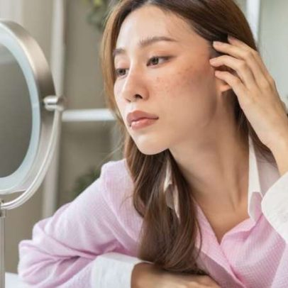 Tensão emocional e hábitos faciais aceleram rugas de expressão