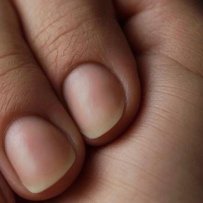 Unhas revelam sinais de doenças e estresse físico ao longo do tempo