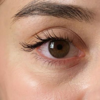 Visão embaçada? Alimentos para proteger a saúde dos olhos