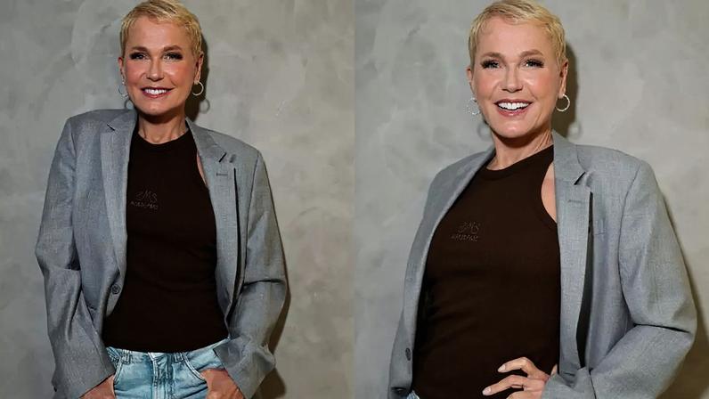 Confira o resultado do transplante capilar da Xuxa