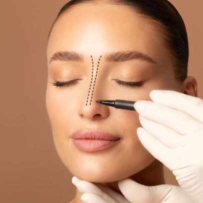 Rinoplastia une melhoria estética à função respiratória
