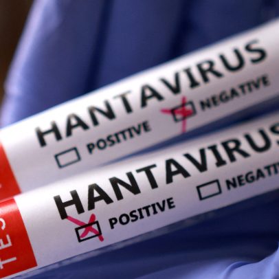 COVID-19, trauma pandêmico e a ansiedade pelo hantavírus