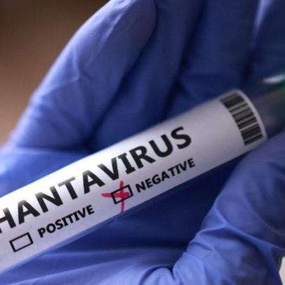 Testes americanos com hantavírus dão negativo; possível caso em Illinois