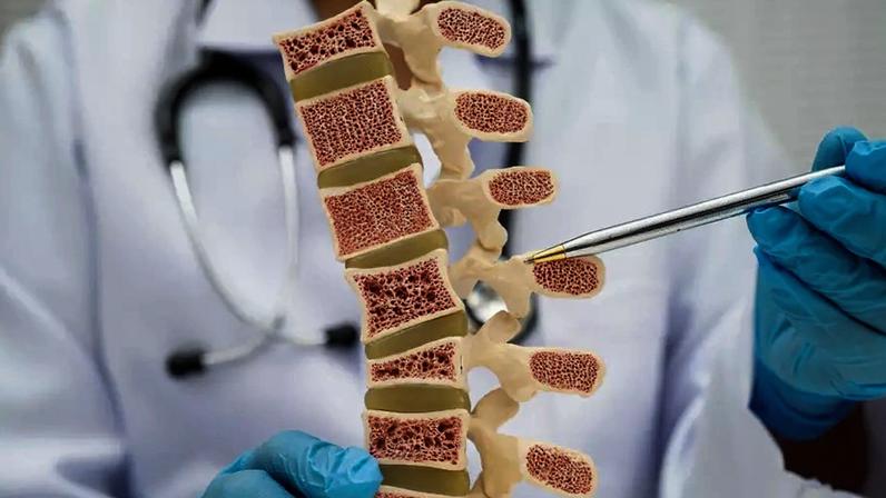 Segundo a reumatologista Maria Luísa Toscano, a identificação precoce da osteoporose previne complicações e reduz o risco de mortalidade