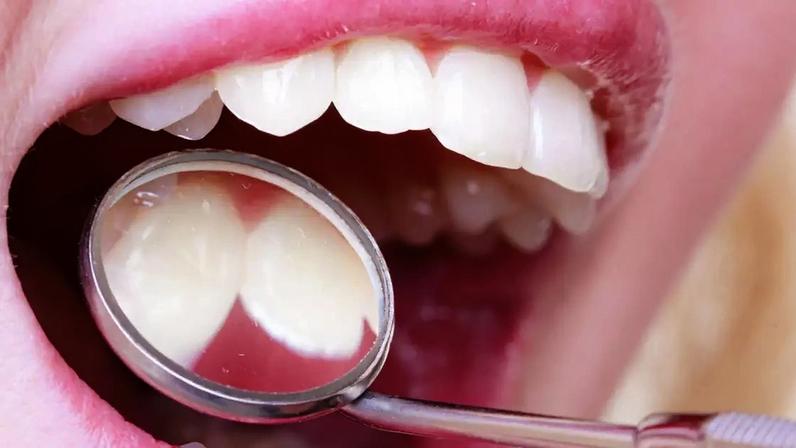Diabetes e saúde da boca estão conectados. Conheça 3 sinais na boca que indicam glicose alta