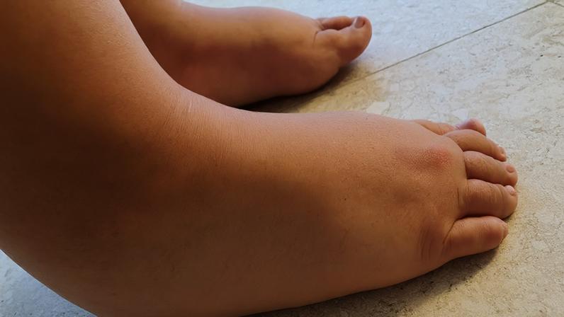 A luta de Dai: arrecadação de fundos para cirurgia urgente