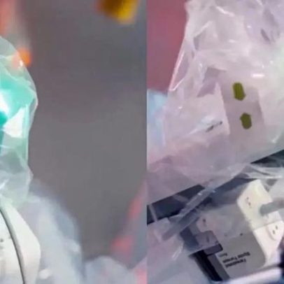 Médico opera paciente em Porto Alegre, vindo da China, em cirurgia histórica