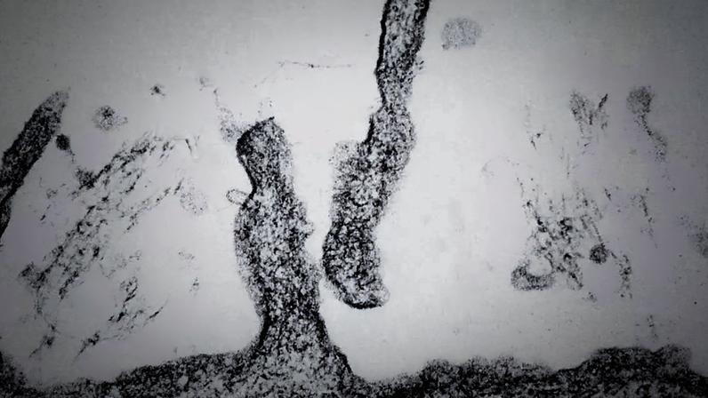 Os hantavírus que causam a Síndrome Pulmonar por Hantavírus (HPS) são transmitidos pelas fezes de roedores