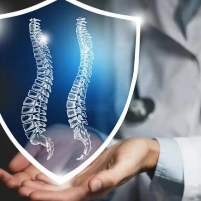 Escoliose em crianças e adolescentes: sinais precoces e impactos na saúde