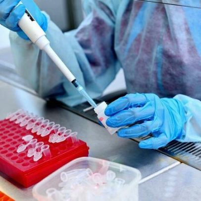 Teste genético pelo SUS auxilia diagnóstico e tratamento do câncer de mama