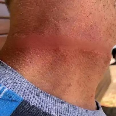 Motociclista fica ferido ao enroscar pescoço em cabo solto em Cascavel