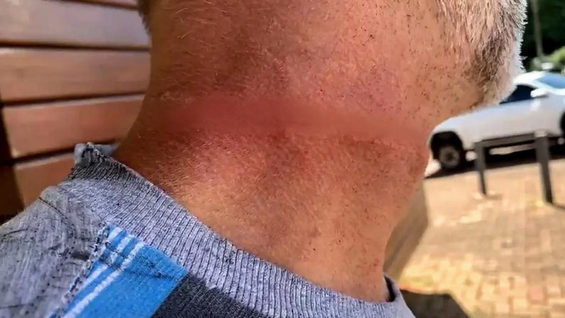 Motociclista fica ferido após enroscar pescoço em cabo solto e cair da moto, em Cascavel