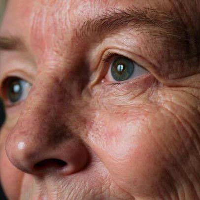Maio verde: laser passa a ganhar espaço no tratamento do glaucoma