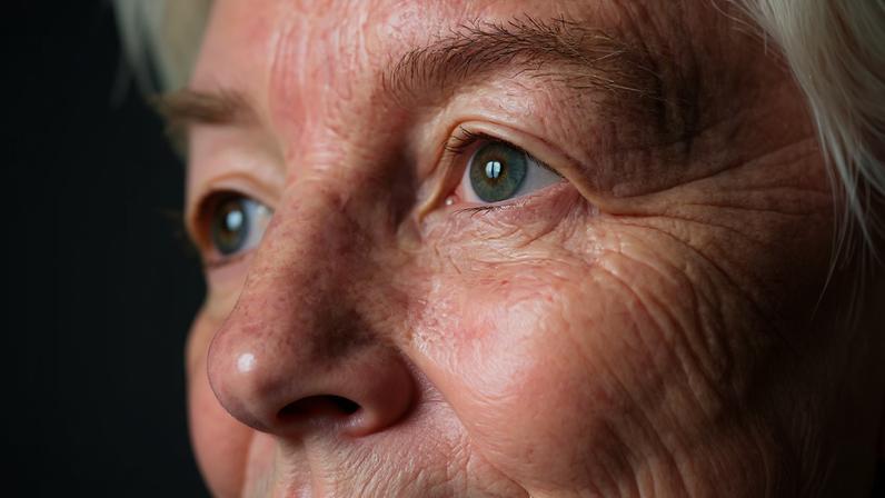 Maio verde: laser passa a ganhar espaço no tratamento do glaucoma