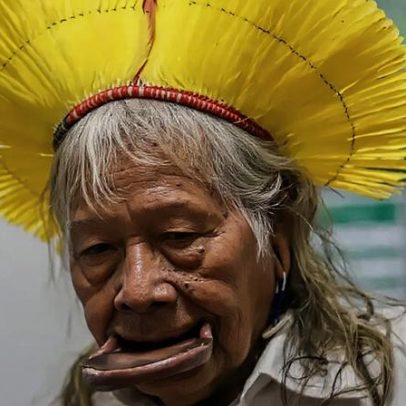 Cacique Raoni permanece em UTI de hospital em Mato Grosso