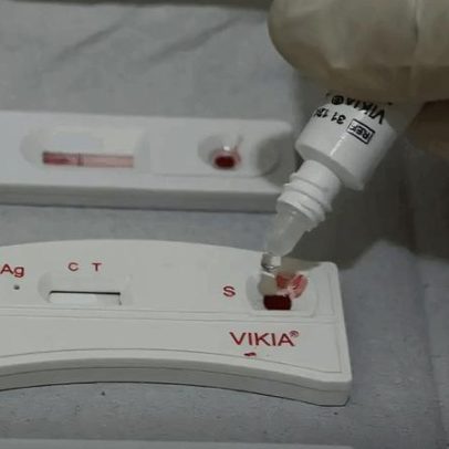 Brasil reduz em 29% as novas infecções por HIV em 2025