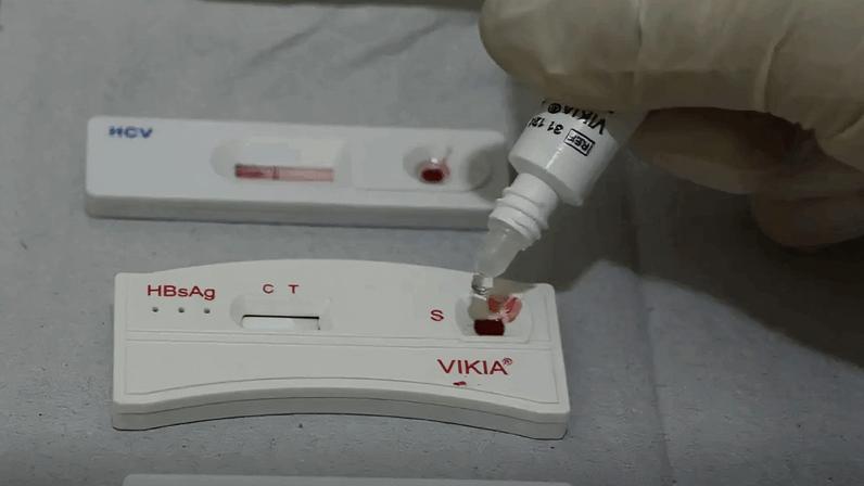Brasil reduz em 29% as novas infecções por HIV em 2025