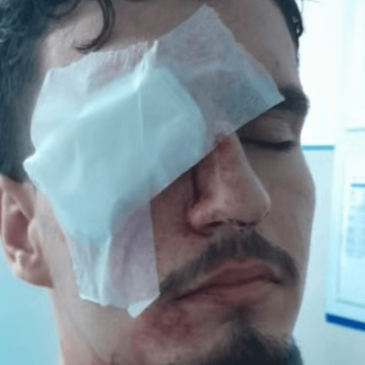 Estudante fica cego após bala de borracha atingir olho na saída do Maracanã
