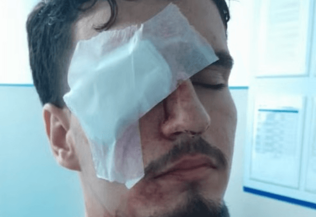 Estudante fica cego após bala de borracha atingir olho na saída do Maracanã