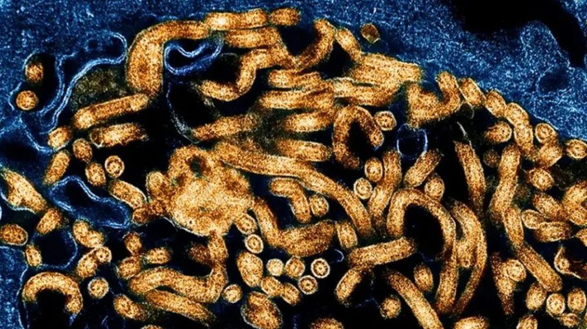Entenda por que o Ebola é um dos vírus mais letais do mundo
