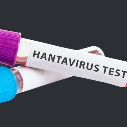 Hantavírus: por que é letal e onde há mais risco no Brasil