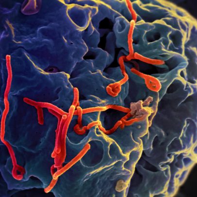 Ebola: o que saber sobre surto na RD Congo