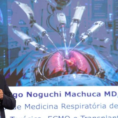 Robô que opera sozinho já existe, mas ainda há contato humano, diz médico