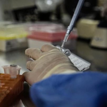 Estimulação de células imunes pode controlar o HIV a longo prazo