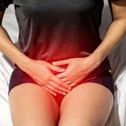Líquen escleroso vulvar: definição e opções de tratamento