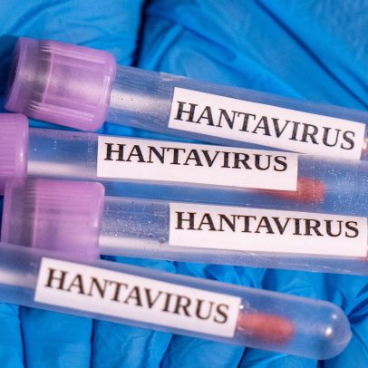 O que você precisa saber sobre o hantavírus