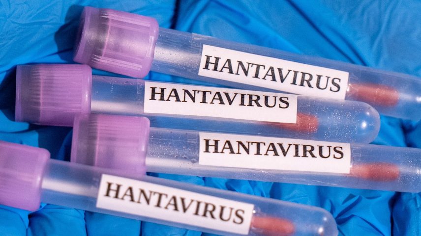 Hantavirus samples