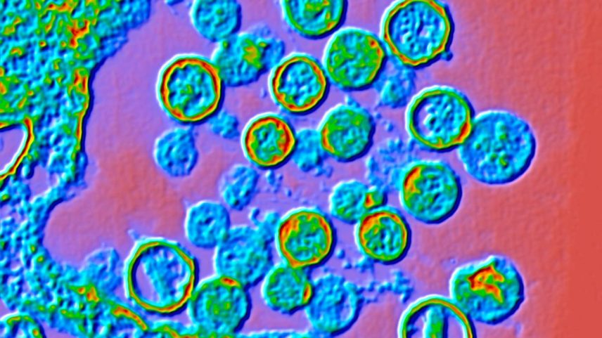 Partículas de hantavírus: patógeno causa insuficiência respiratória e tem taxa de mortalidade de 50% (Foto: GI/Getty Images)