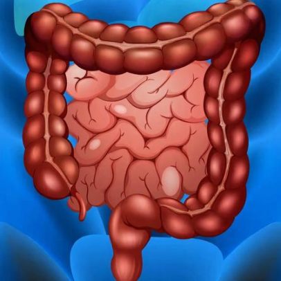 SUS amplia rastreamento de câncer de intestino com novo exame