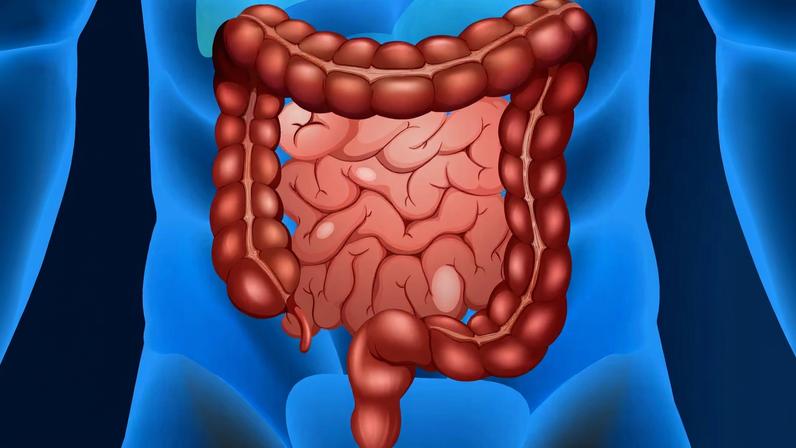 Câncer de intestino é o segundo mais frequente no Brasil