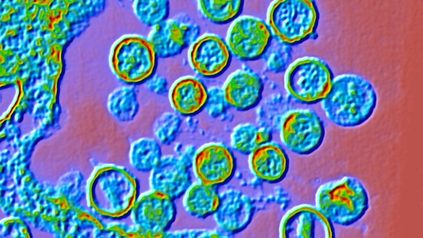 Micrografia eletrônica de transmissão (TEM) colorida de partículas de Hantavírus. Metrópoles
