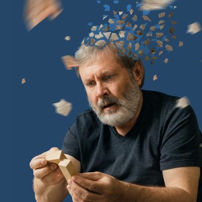 Maior estudo sobre remédios para Alzheimer gera polêmica entre cientistas
