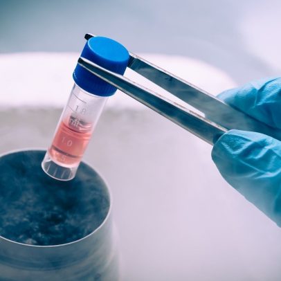 Cientistas reverteram envelhecimento de células-tronco no sangue
