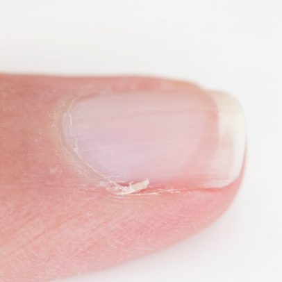 Como remover cutículas soltas com segurança