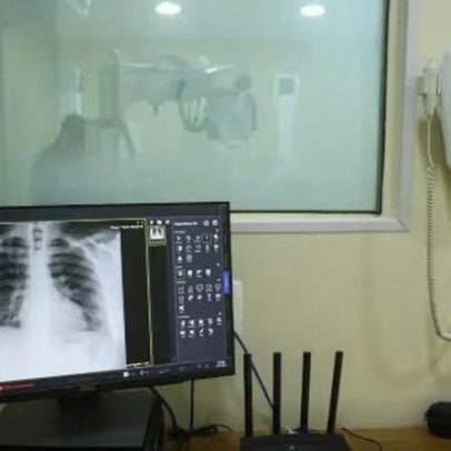 Isenção de IR desatualizada não acompanha avanços médicos e novas doenças