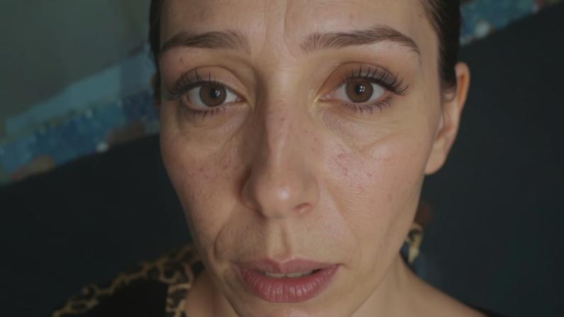 Alice Martins, de 33 anos, foi brutalmente espancada, teve o nariz e costelas quebrados e o intestino perfurado