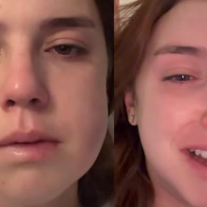 Alice Wegmann surge irreconhecível e revela ter chorado após remoção de siso