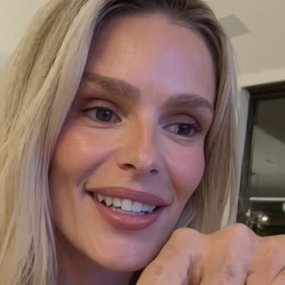 Yasmin Brunet relembra descoberta inusitada sobre lipedema