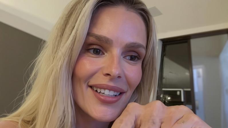 Yasmin Brunet relembra descoberta inusitada sobre lipedema