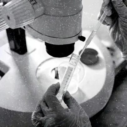 Técnica genética pode evitar a síndrome de Down