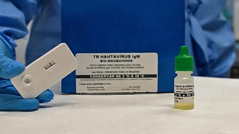 Dados do Ministério da Saúde mostram que o Brasil registrou sete casos confirmados de hantavirose em 2026