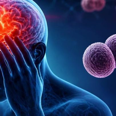 Meningite bacteriana pode evoluir em horas: entenda os sinais e riscos