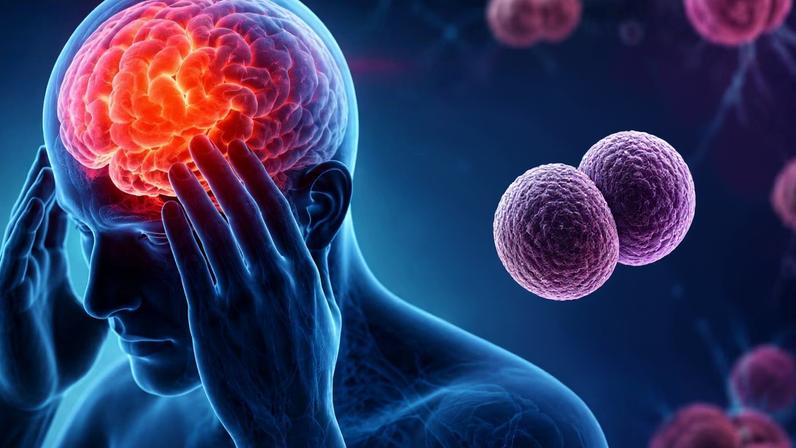 Meningite bacteriana evolui em poucas horas. (Foto: Fala Ciência via ChatGPT)